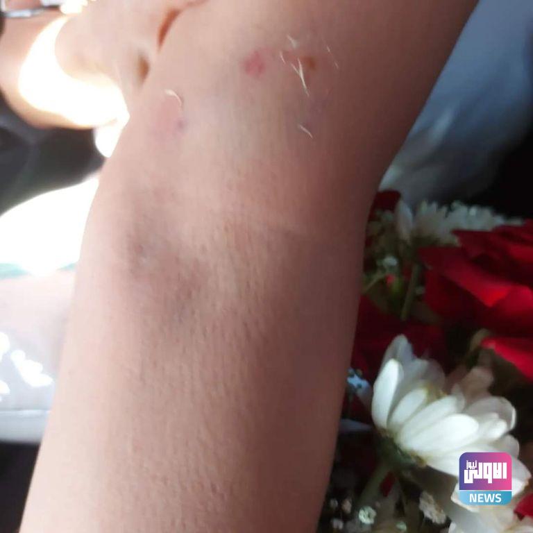 مادلين طبر تتعرض لعضة أسد على الهواء (فيديو وصور) 10 173 183738 madeleine tober bite lion 4