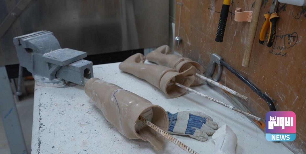 مركز الأطراف الصناعية بالفلوجة: وزارة الصحة جهزتنا من مناشئ عالمية رصينة (صور) 7 upload 1691486090 110922461 edit 220279022665129